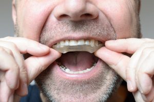 Man Putting In Mouth Guard