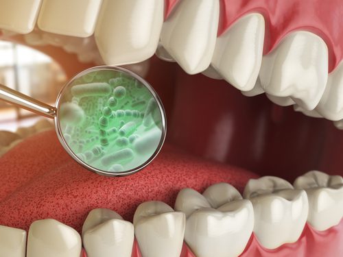 bacterias and viruses around tooth-img-blog
