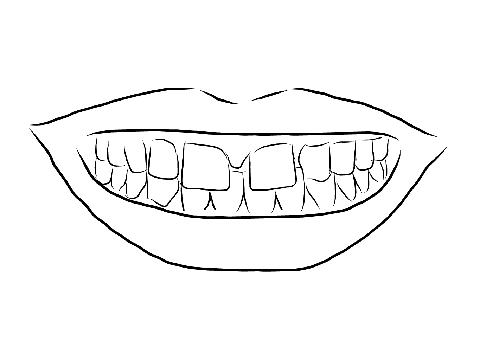 Drawing of gapped tooth smile