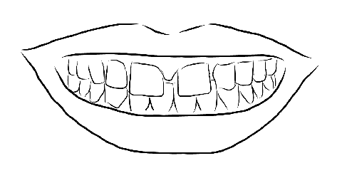 Drawing of gapped tooth smile