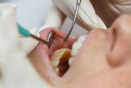 Dental Checkup image of mouth