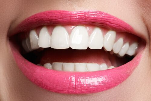 woman smile with great teeth-img-blog