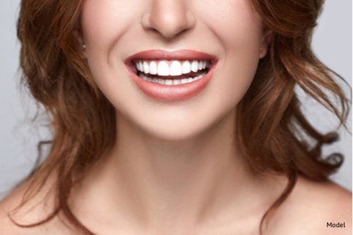 woman with beautiful smile ho has benefited from dental bonding and fillers-img-blog