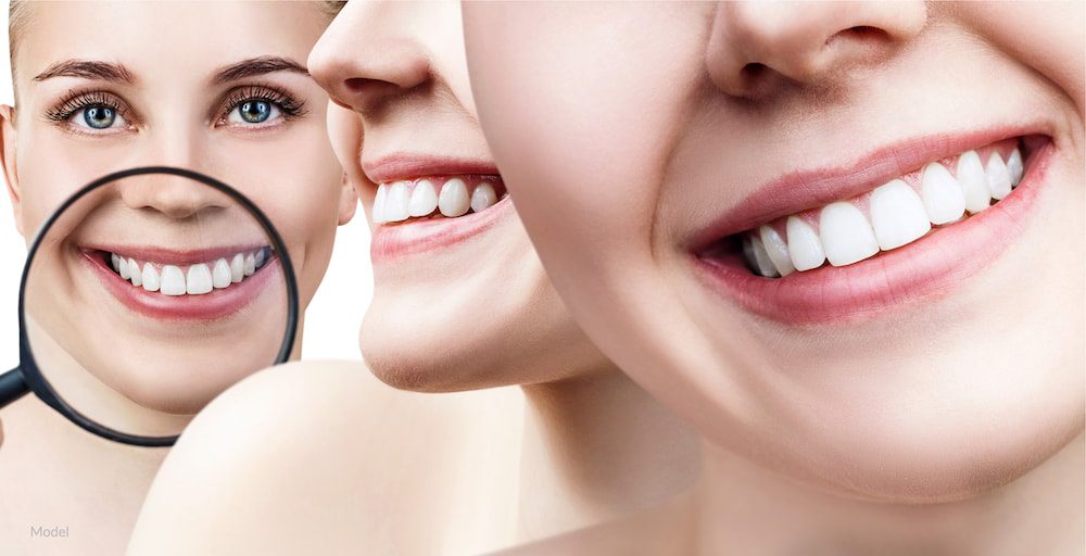 Woman with bright white smile highlighted with magnifying glass after teeth whitening.
