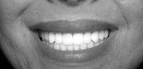 Up close of a woman's smile