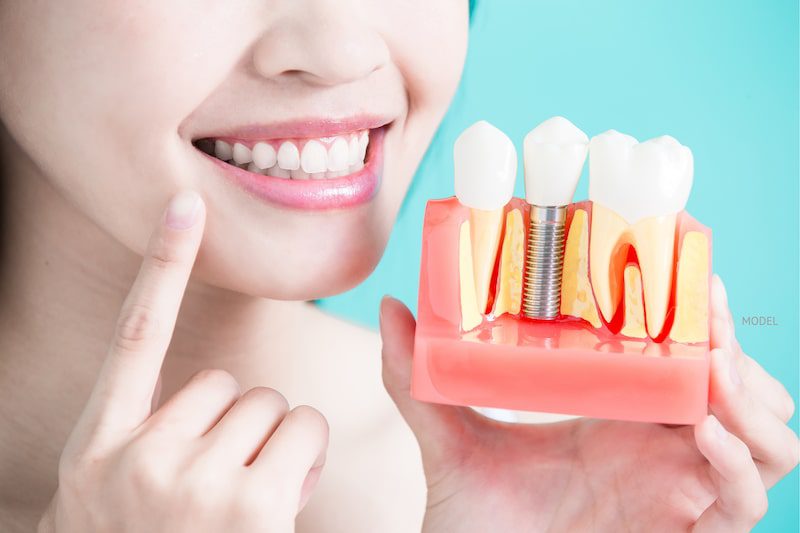 Woman pointing to her teeth while holding a model of a dental implant against a blue background.