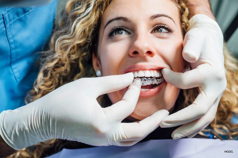 A dentist's hands placing Invisalign Aligners on a female patient's teeth.