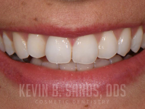 Before Image